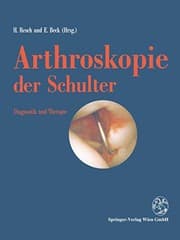 Tapa de Arthroskopie der Schulter