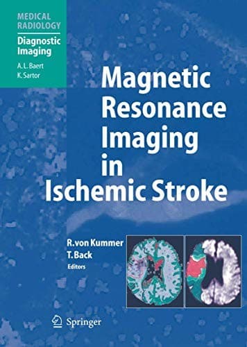 Tapa de Magnetic Resonance Imaging in Ischemic Stroke