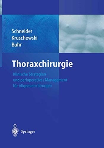 Tapa de Thoraxchirurgie