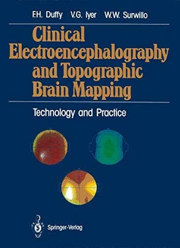 Tapa de Clinical Electroencephalography and Topographic Brain Mapping