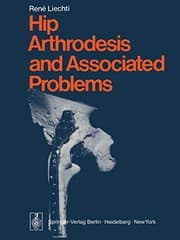 Tapa de Hip Arthrodesis and Associated Problems