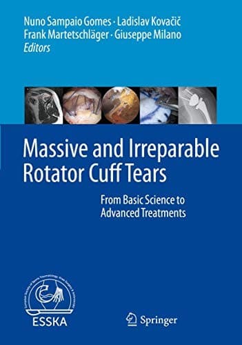 Tapa de Massive and Irreparable Rotator Cuff Tears