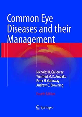 Tapa de Common Eye Diseases and their Management
