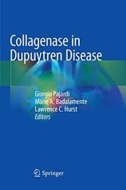 Tapa de Collagenase in Dupuytren Disease