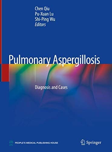 Tapa de Pulmonary Aspergillosis