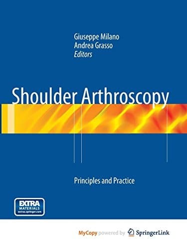 Tapa de Shoulder Arthroscopy