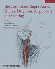Tapa de Carotid and Supra-Aortic Trunks