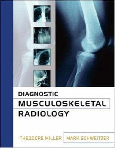 Tapa de Diagnostic Musculoskeletal Radiology