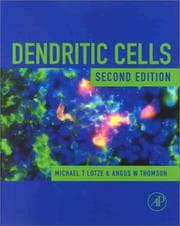 Tapa de Dendritic cells