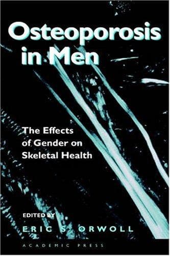 Tapa de Osteoporosis in Men