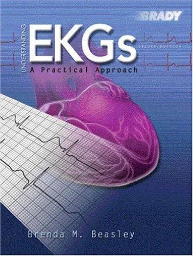 Tapa de Understanding EKGs