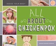 Tapa de All about Chickenpox