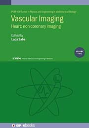 Tapa de Vascular Imaging : Heart