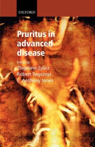 Tapa de Pruritus in advanced disease