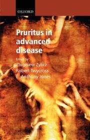 Tapa de Pruritus in advanced disease