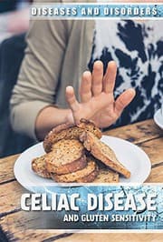 Tapa de Celiac Disease and Gluten Sensitivity
