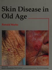 Tapa de Skin disease in old age