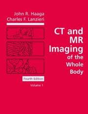 Tapa de CT and MR Imaging of the Whole Body