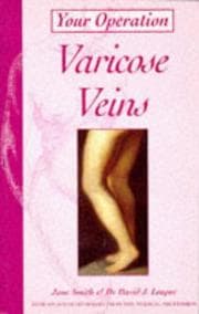 Tapa de Varicose veins