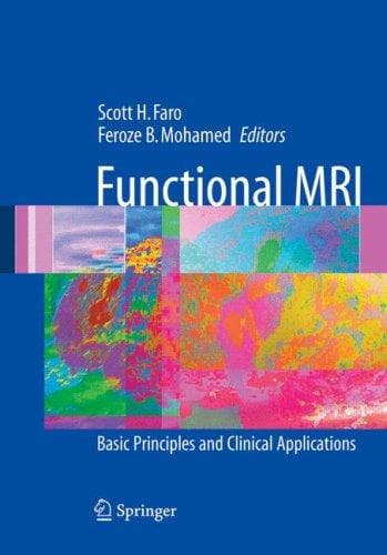 Tapa de Functional MRI