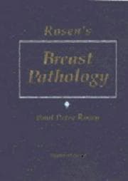 Tapa de Rosen's breast pathology
