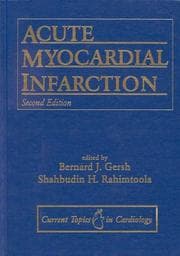 Tapa de Acute myocardial infarction