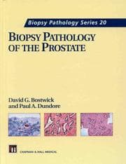 Tapa de Biopsy pathology of prostate