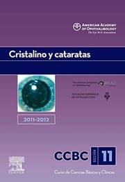 Tapa de Cristalino y cataratas. 2011-2012