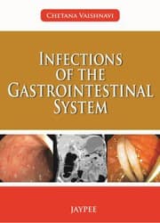 Tapa de Infections of the gastrointestinal system