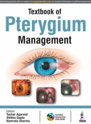 Tapa de Textbook of Pterygium Management