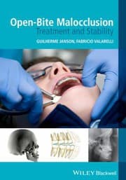 Tapa de Open-Bite Malocclusion
