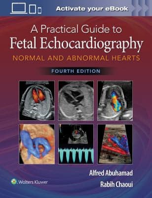 Tapa de Practical Guide to Fetal Echocardiography