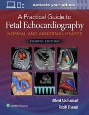 Tapa de Practical Guide to Fetal Echocardiography