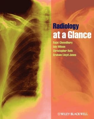 Tapa de Radiology at a glance