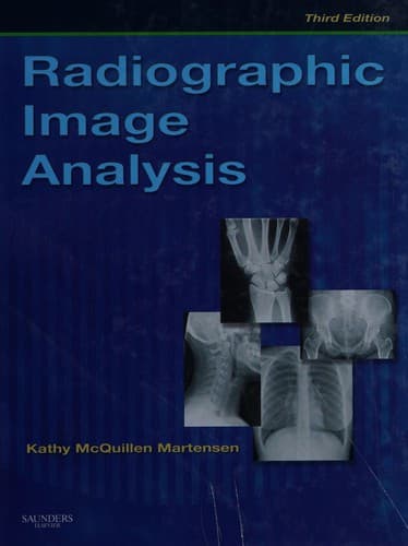Tapa de Radiographic image analysis