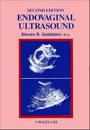 Tapa de Endovaginal ultrasound