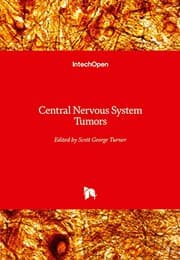 Tapa de Central Nervous System Tumors