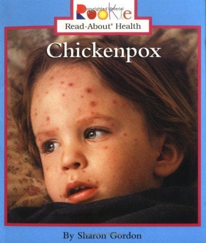 Tapa de Chickenpox