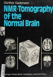 Tapa de NMR-tomography of the normal brain