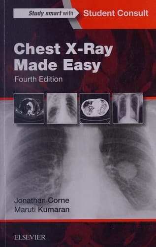 Tapa de Chest X-Ray Made Easy