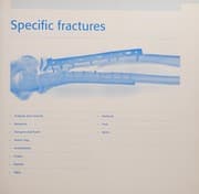 Tapa de AO principles of fracture management