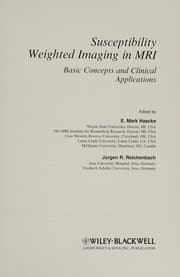 Tapa de Susceptibility weighted imaging in MRI : basic concepts and clinical applications