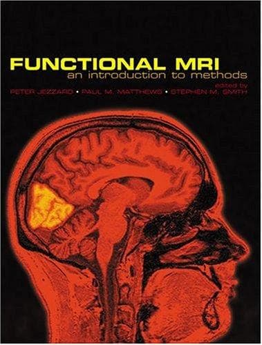 Tapa de Functional MRI