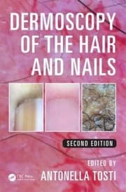 Tapa de Dermoscopy of the Hair and Nails, Second Edition