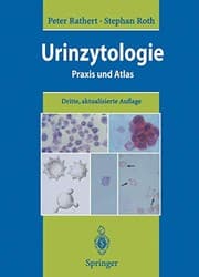 Tapa de Urinzytologie