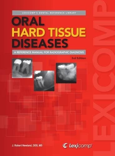 Tapa de Oral hard tissue diseases