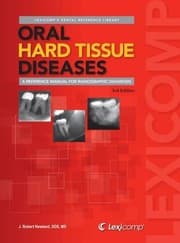 Tapa de Oral hard tissue diseases