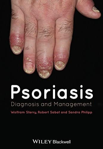 Tapa de Psoriasis