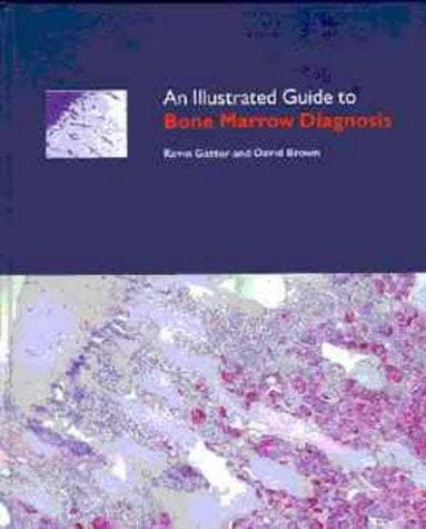 Tapa de Illustrated Guide to Bone Marrow Diagnosis