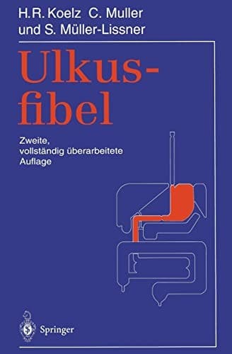 Tapa de Ulkusfibel